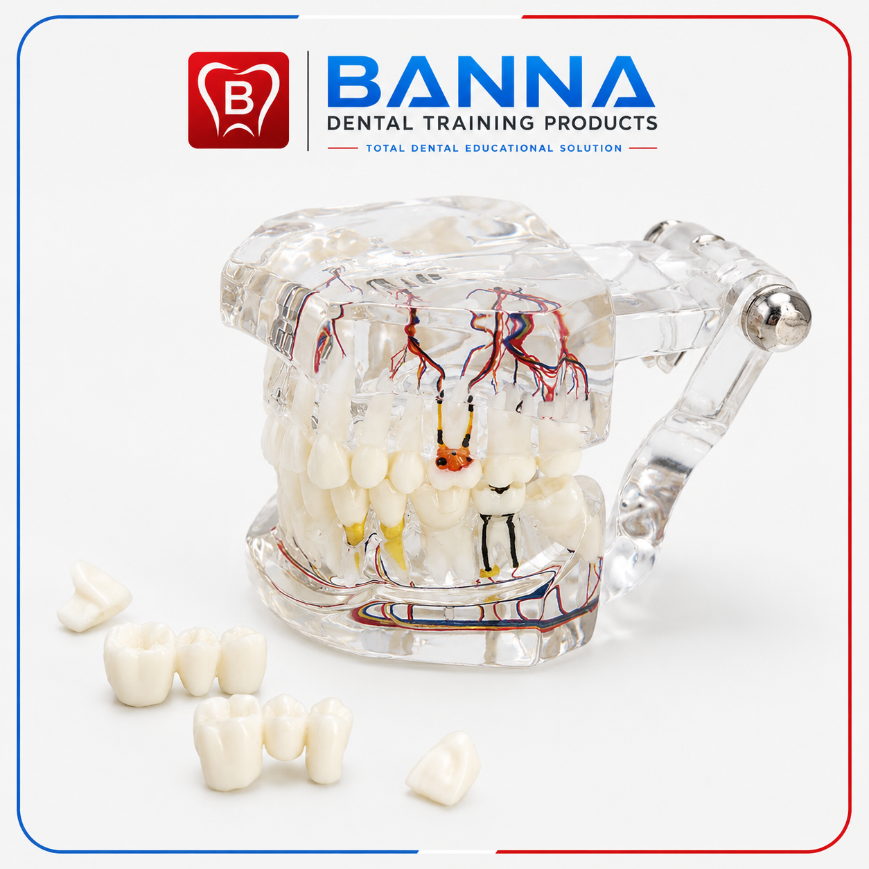 BANNA Transparent Dental Pathology Model
